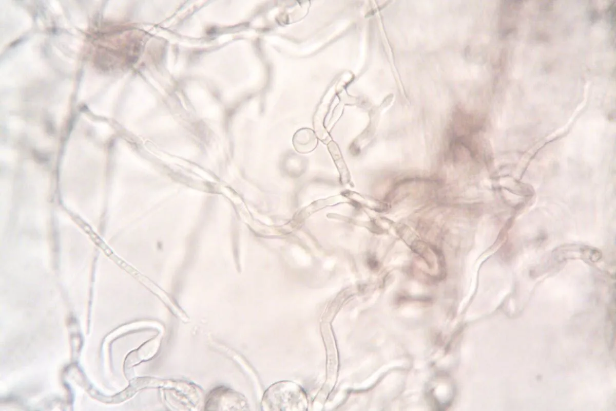 Biopelicula en Torres de Enfriamiento: Riesgos y Control